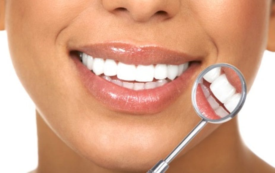 Teeth whitening in Covent Garden – treatments to avoid