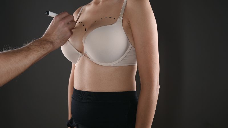 Understanding Breast Augmentation: Miami Experts Share Insights